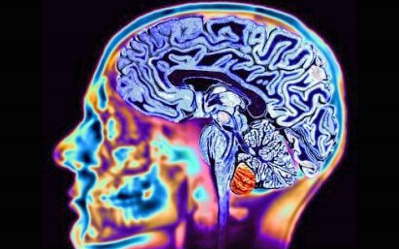 Enfermedad de Huntington - Centro especializado en enfermedades neurodegenerativas CEDAEN Enfermedad de Huntington - Centro especializado en enfermedades neurodegenerativas CEDAEN